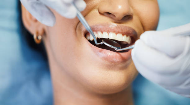 Best Emergency Treatment for Dental Infections or Abscesses in Wharton, NJ